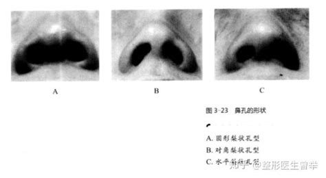 鼻孔中間叫什麼|鼻整形科普：认识鼻背、鼻尖、鼻翼、鼻小柱、鼻孔分。